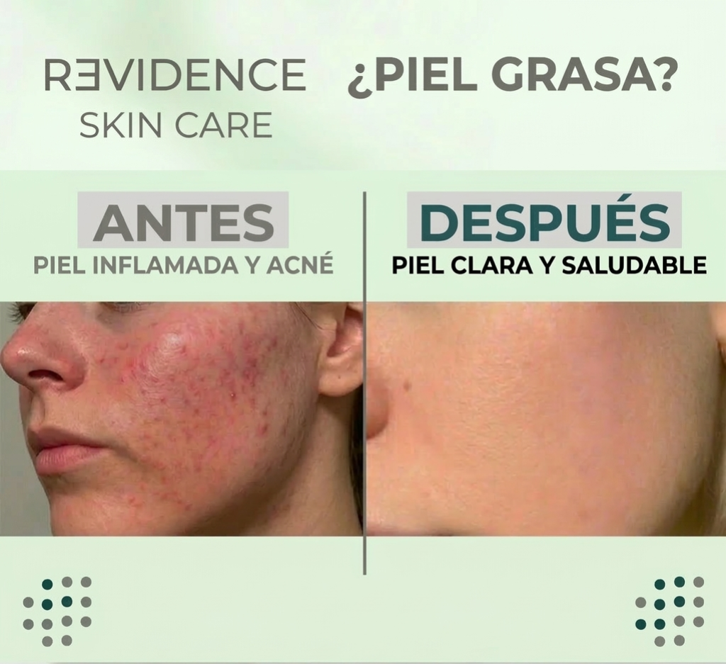 Serum de Niacinamida 10% con Zinc  1% y Acido Hialuronico